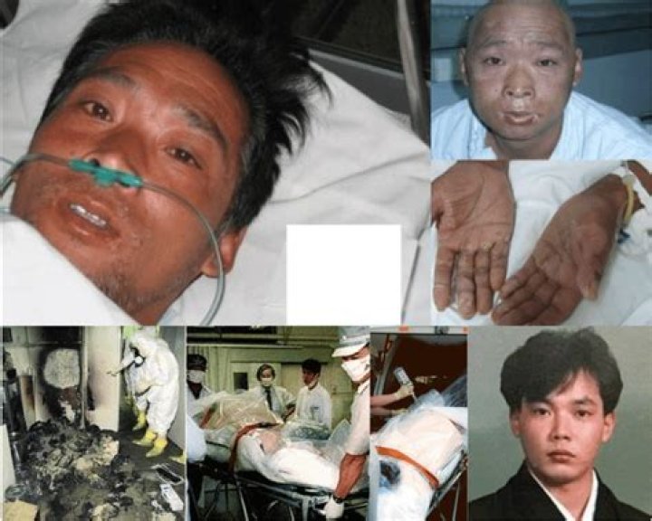 The Tragic Case Of Hisashi Ouchi: A Japanese Nuclear Accident Victim
