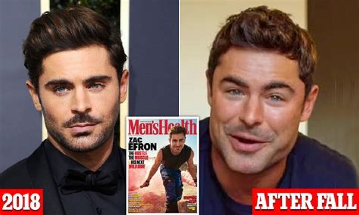 The Truth Behind Zac Efron's Plastic Surgery Rumors